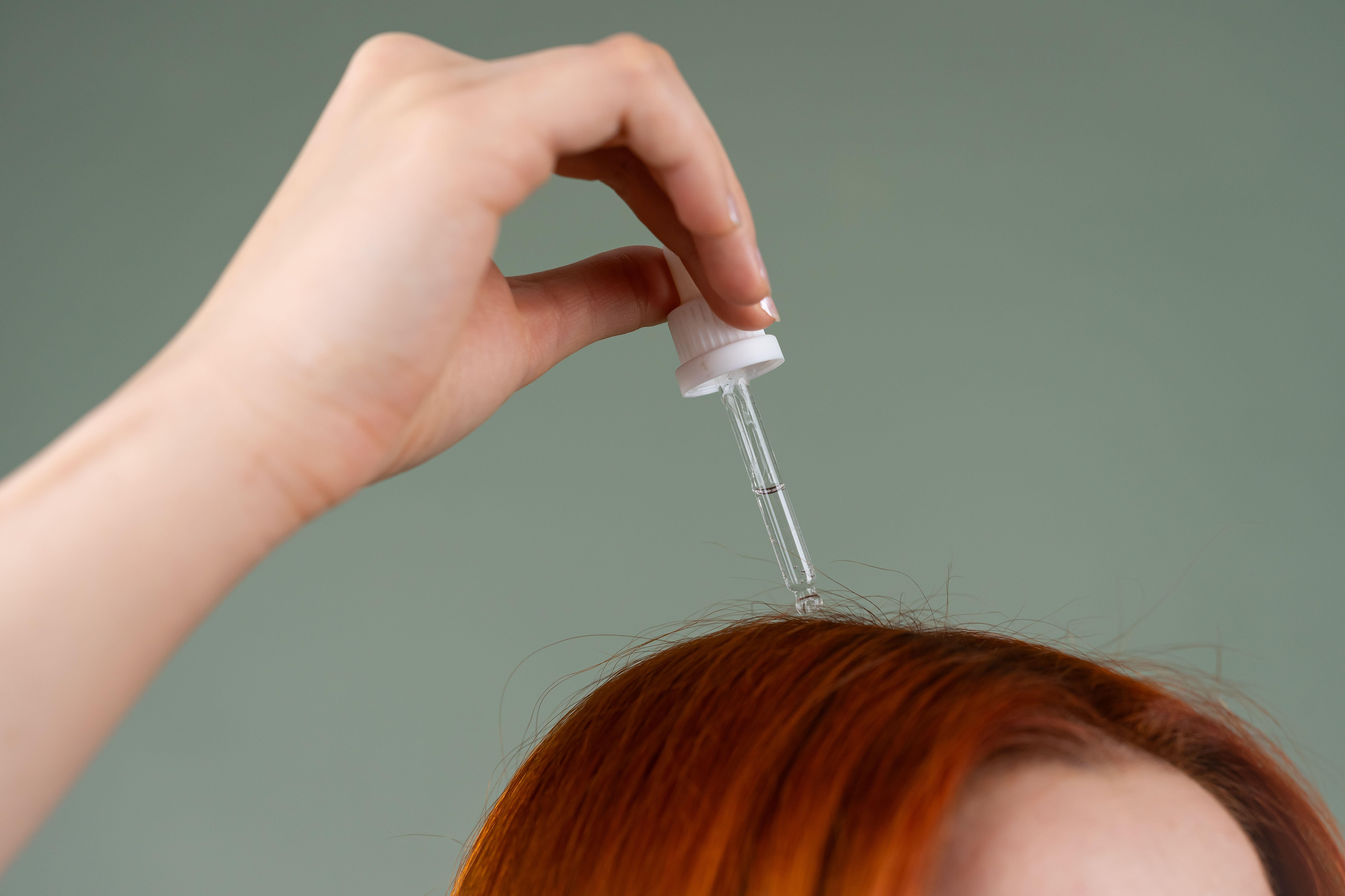 Minoxidil vs. Finasteride for Hair Loss